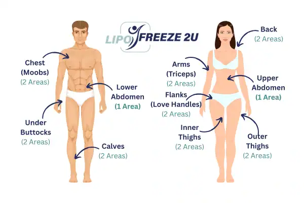 Areas you can have fat freezing treatment Taunton