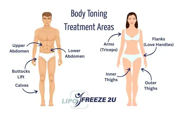 Graphic showing where you can have Body toning Treatment Taunton on your body