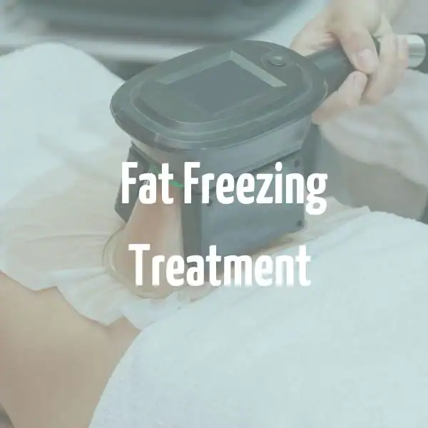 fat freezing treatment Taunton