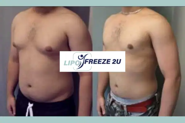 How Long Does It Take to See Results Taunton?