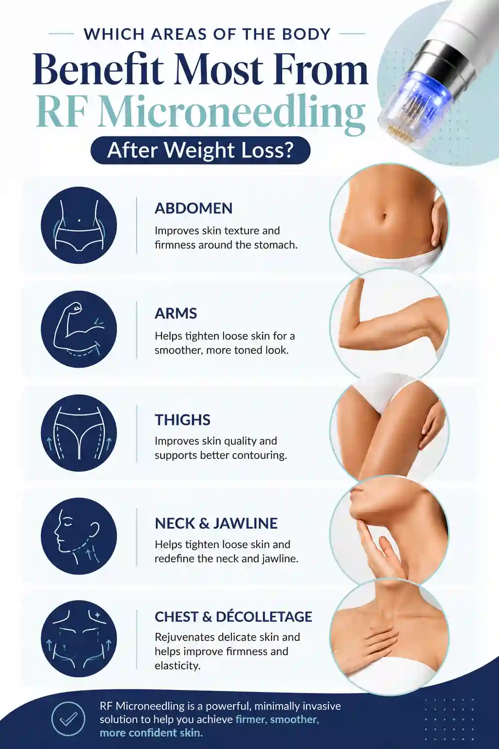 Which Areas of the Body Benefit Most From RF Microneedling After Weight Loss Taunton